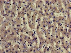 Invitrogen TRADD Polyclonal Antibody 100 &mu;g; Unconjugated:Antibodies,