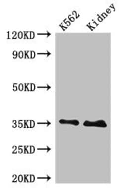 Invitrogen TRADD Polyclonal Antibody 100 &mu;g; Unconjugated:Antibodies,