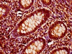 Invitrogen ITSN1 Polyclonal Antibody 100 &mu;g; Unconjugated:Antibodies,
