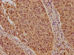 Invitrogen KPNB1 Polyclonal Antibody 100 &mu;L; Unconjugated:Antibodies,