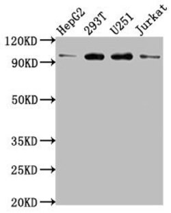 Invitrogen KPNB1 Polyclonal Antibody 100 &mu;L; Unconjugated:Antibodies,