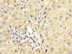 PCBP2 Polyclonal Antibody, Invitrogen 100 &mu;g; Unconjugated:Antibodies,