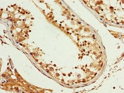 PCBP2 Polyclonal Antibody, Invitrogen 100 &mu;g; Unconjugated:Antibodies,