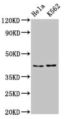 PCBP2 Polyclonal Antibody, Invitrogen 100 &mu;g; Unconjugated:Antibodies,