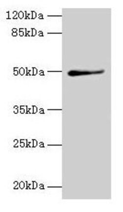 Invitrogen TRIP13 Polyclonal Antibody 100 &mu;g | Buy Online | Invitrogen&trade; | Fisher Scientific