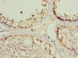 Invitrogen TOMM34 Polyclonal Antibody 100 &mu;L; Unconjugated:Antibodies,
