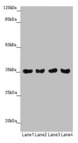 Invitrogen TOMM34 Polyclonal Antibody 100 &mu;L; Unconjugated:Antibodies,