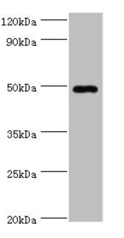 Invitrogen HYAL1 Polyclonal Antibody 100 &mu;L; Unconjugated:Antibodies,
