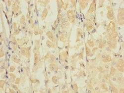 Invitrogen GluR7 Polyclonal Antibody 100 &mu;L; Unconjugated:Antibodies,
