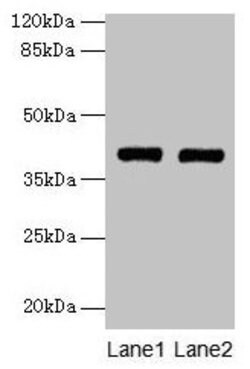 MAB21L1 Polyclonal Antibody:Antibodies, Polyclonal