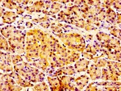 Invitrogen IL18R1 Polyclonal Antibody 100 &mu;g; Unconjugated:Antibodies,