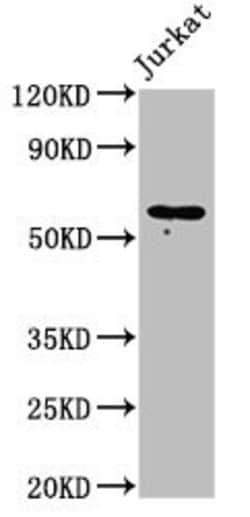 Invitrogen IL18R1 Polyclonal Antibody 100 &mu;g; Unconjugated:Antibodies,