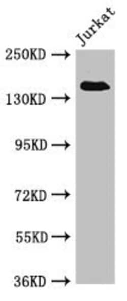 Invitrogen eIF3a Polyclonal Antibody 100 &mu;g; Unconjugated:Antibodies,