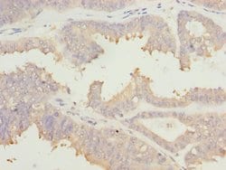 eIF2b alpha Polyclonal Antibody:Antibodies, Polyclonal