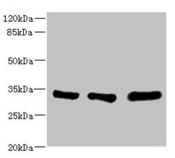 eIF2b alpha Polyclonal Antibody:Antibodies, Polyclonal
