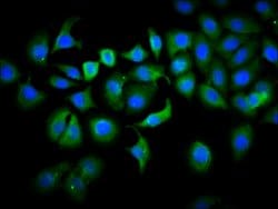 Invitrogen PLS1 Polyclonal Antibody 100 &mu;g; Unconjugated:Antibodies,