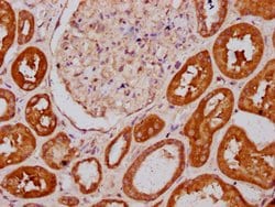 Invitrogen PLS1 Polyclonal Antibody 100 &mu;g; Unconjugated:Antibodies,