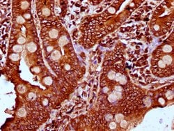 Invitrogen PLS1 Polyclonal Antibody 100 &mu;g; Unconjugated:Antibodies,