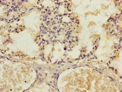 Invitrogen KIZUNA Polyclonal Antibody 100 &mu;L; Unconjugated:Antibodies,