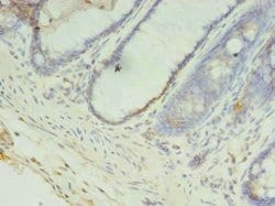 Invitrogen CCDC57 Polyclonal Antibody 100 &mu;g; Unconjugated:Antibodies,