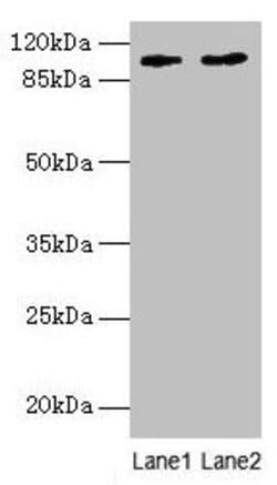 Invitrogen CCDC57 Polyclonal Antibody 100 &mu;g; Unconjugated:Antibodies,