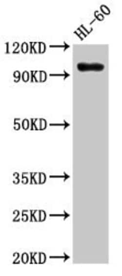 Invitrogen SUV420H1 Polyclonal Antibody 100 &mu;g; Unconjugated:Antibodies,