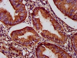 C5orf33 Polyclonal Antibody:Antibodies, Polyclonal