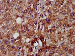 C5orf33 Polyclonal Antibody:Antibodies, Polyclonal
