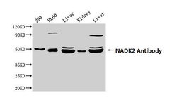 C5orf33 Polyclonal Antibody:Antibodies, Polyclonal