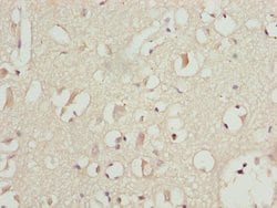 Invitrogen PITRM1 Polyclonal Antibody 100 &mu;L; Unconjugated:Antibodies,