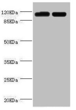 Invitrogen PITRM1 Polyclonal Antibody 100 &mu;L; Unconjugated:Antibodies,