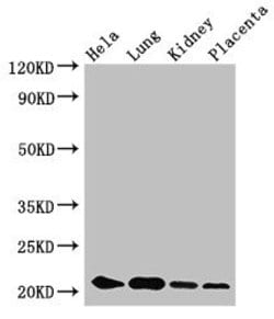 Invitrogen KRBOX4 Polyclonal Antibody 100 &mu;g; Unconjugated:Antibodies,