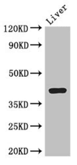 Invitrogen ADH7 Polyclonal Antibody 100 &mu;g | Buy Online | Invitrogen&trade; | Fisher Scientific