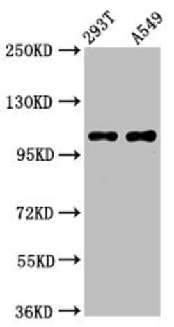 Invitrogen NARG2 Polyclonal Antibody 100 &mu;g; Unconjugated:Antibodies,