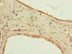 Invitrogen PPP2R2D Polyclonal Antibody 100 &mu;g; Unconjugated:Antibodies,