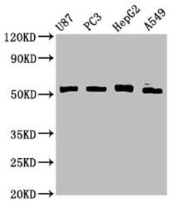 Invitrogen PPP2R2D Polyclonal Antibody 100 &mu;g; Unconjugated:Antibodies,