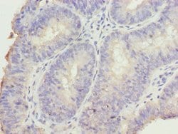 DDI2 Polyclonal Antibody:Antibodies, Polyclonal