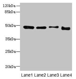 DDI2 Polyclonal Antibody:Antibodies, Polyclonal