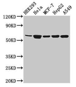 Invitrogen&trade;&nbsp;CYP4F22 Polyclonal Antibody