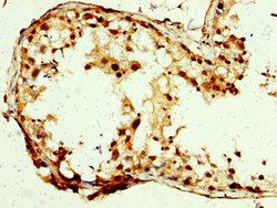 Invitrogen SLC25A24 Polyclonal Antibody 100 &mu;g; Unconjugated:Antibodies,