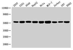 Invitrogen SLC25A24 Polyclonal Antibody 100 &mu;g; Unconjugated:Antibodies,