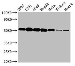Invitrogen SLC25A24 Polyclonal Antibody 100 &mu;g; Unconjugated:Antibodies,