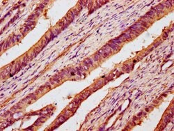 Invitrogen B3GNT6 Polyclonal Antibody 100 &mu;g; Unconjugated:Antibodies,