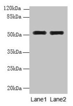 Invitrogen WDR88 Polyclonal Antibody 100 &mu;g; Unconjugated:Antibodies,