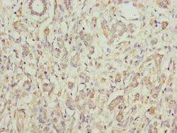 Invitrogen PCID1 Polyclonal Antibody 100 &mu;L | Buy Online | Invitrogen&trade; | Fisher Scientific