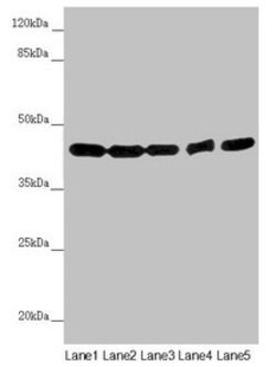 Invitrogen PCID1 Polyclonal Antibody 100 &mu;L | Buy Online | Invitrogen&trade; | Fisher Scientific