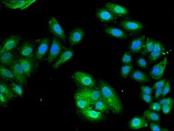 Invitrogen PCID1 Polyclonal Antibody 100 &mu;g | Buy Online | Invitrogen&trade; | Fisher Scientific