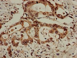Invitrogen PCID1 Polyclonal Antibody 100 &mu;g | Buy Online | Invitrogen&trade; | Fisher Scientific