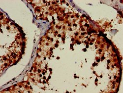 Invitrogen PCID1 Polyclonal Antibody 100 &mu;g | Buy Online | Invitrogen&trade; | Fisher Scientific