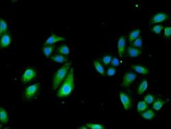 Invitrogen TCTN3 Polyclonal Antibody 100 &mu;g; Unconjugated:Antibodies,